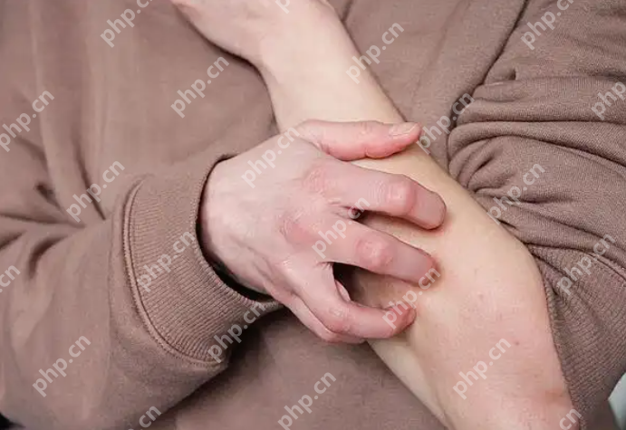 秋季过敏高发，医生提醒：切莫忽视“小”症状 - php中文网